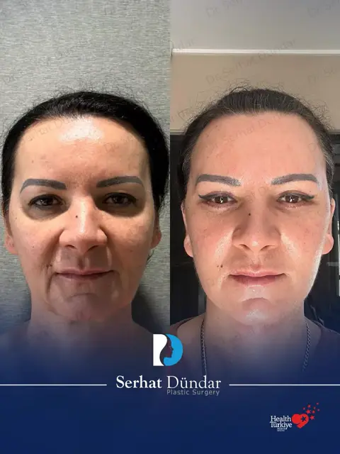Derin Plan Yüz ve Boyun Germe + Şakak Germe
