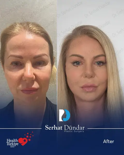 Derin Plan Yüz ve Boyun Germe + Şakak Germe