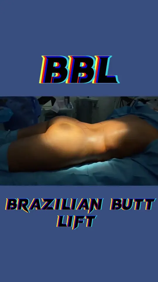 BBL (Popo Estetiği)