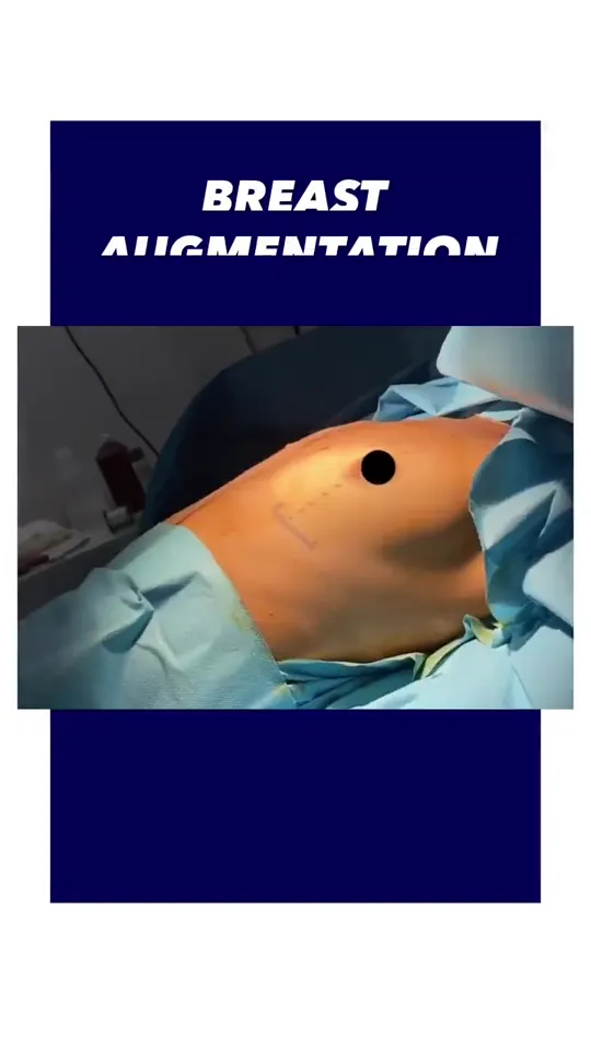 Meme Büyütme